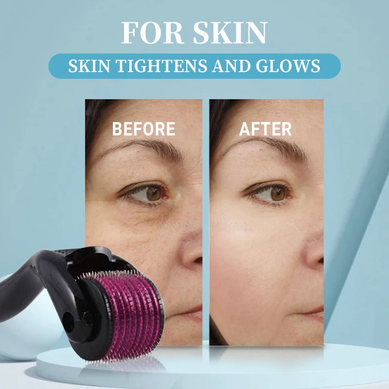 Microneedle Derma Roller — 540 Titanium Needles for Face, Scalp & Beard Growth